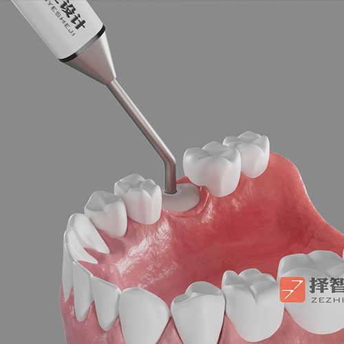 上海苏州动画设计医疗牙齿动画 自动化3D动画演示 机械模拟仿真动画演示 产品宣传动画